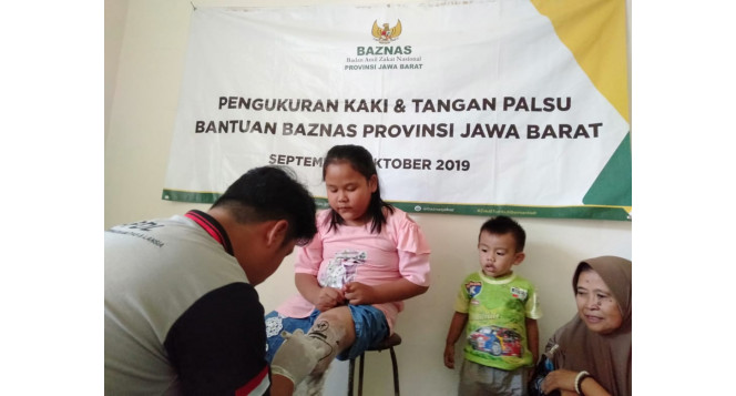 Bantuan Kaki dan Tangan Palsu Untuk Sahabat Disabilitas